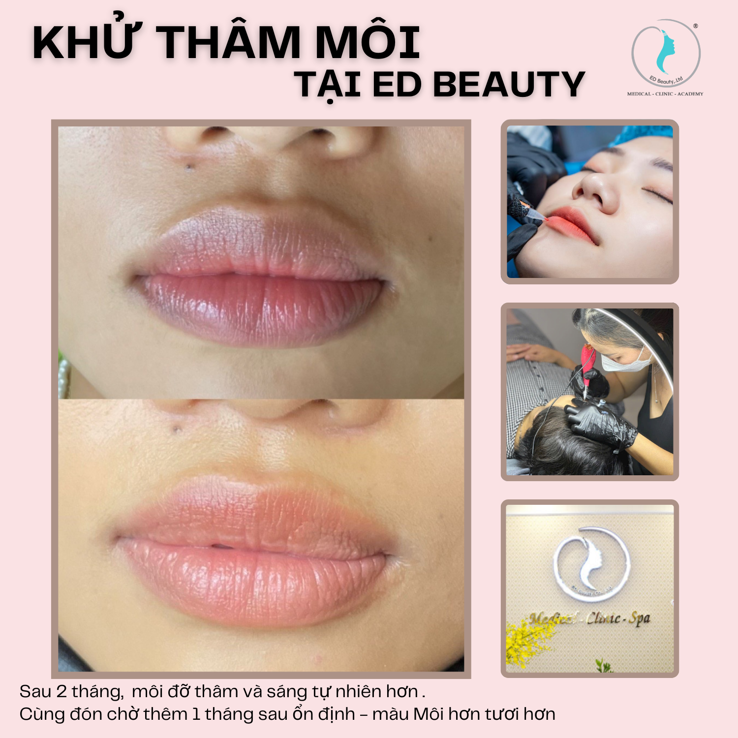 HÌNH ẢNH KHÁCH HÀNG ĐÃ SỬ DỤNG DV TẠI EDBEAUTY