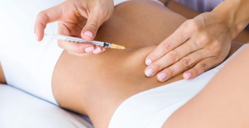 Thẩm mỹ không phẫu thuật - Tiêm giảm béo công nghệ RF, LIPO