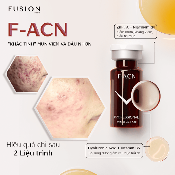 Fusion F-ACN có gì để cải thiện da mụn?