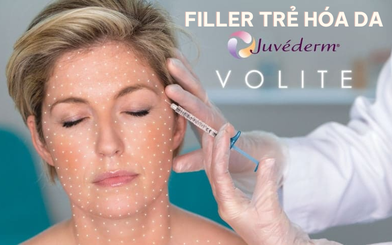 Tiêm Filler Juvederm Volite 