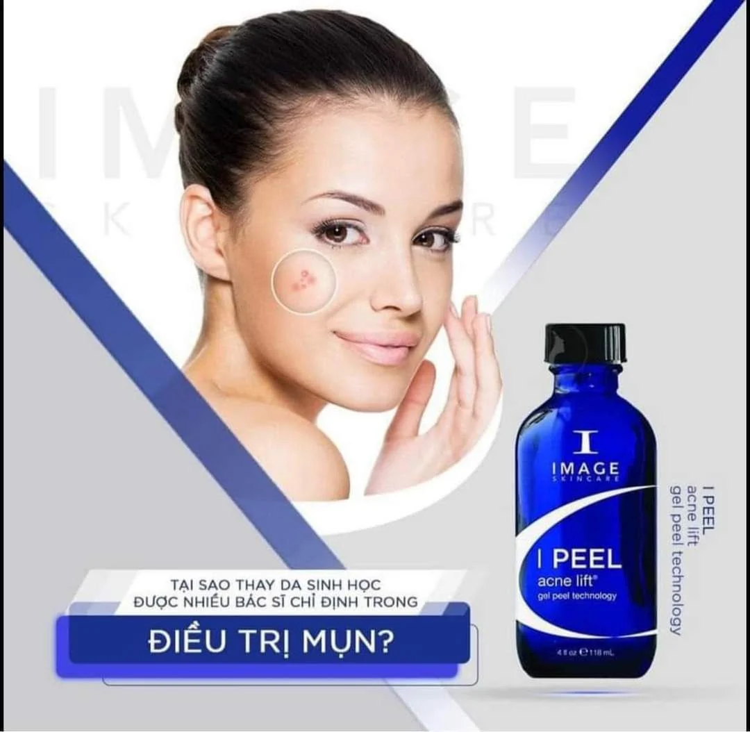 3. Peel trị mụn Image Skincare IPeel Acne Lift