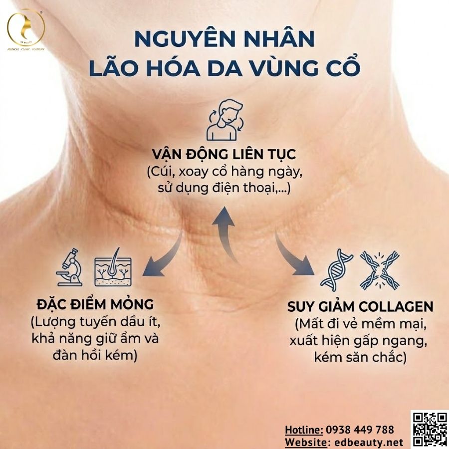 Nhiều nguyên nhân khiến vùng cổ lão hóa