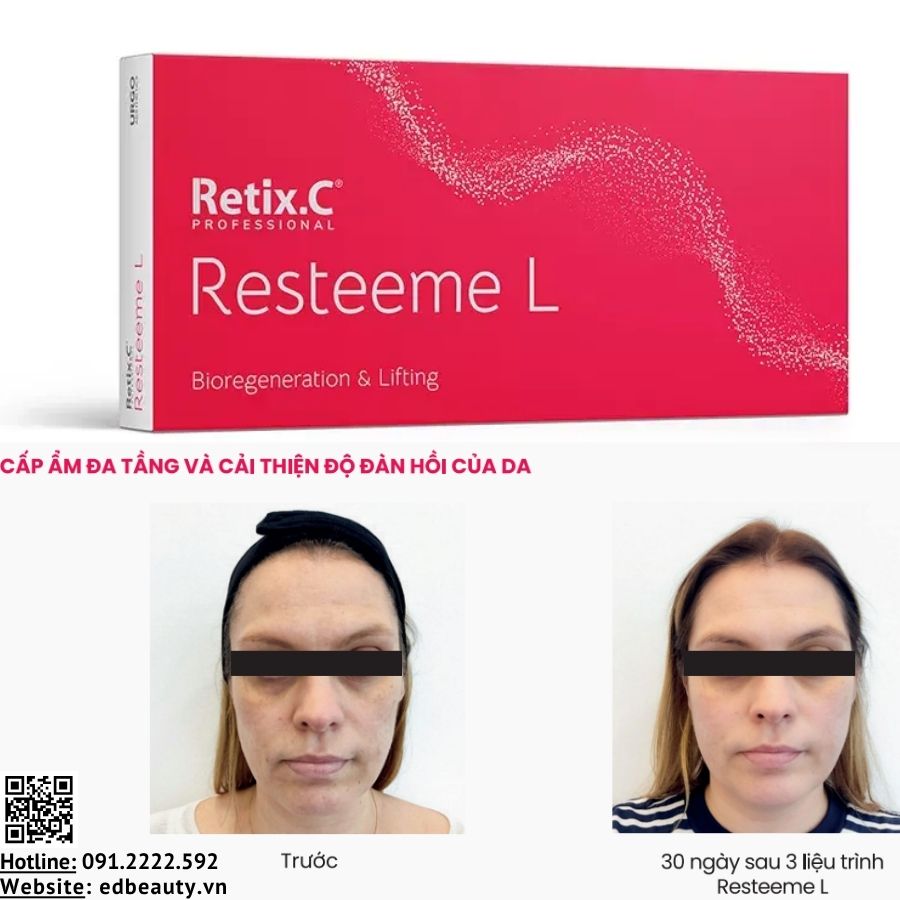 Resteeme L - Tái tạo sinh học và nâng cơ