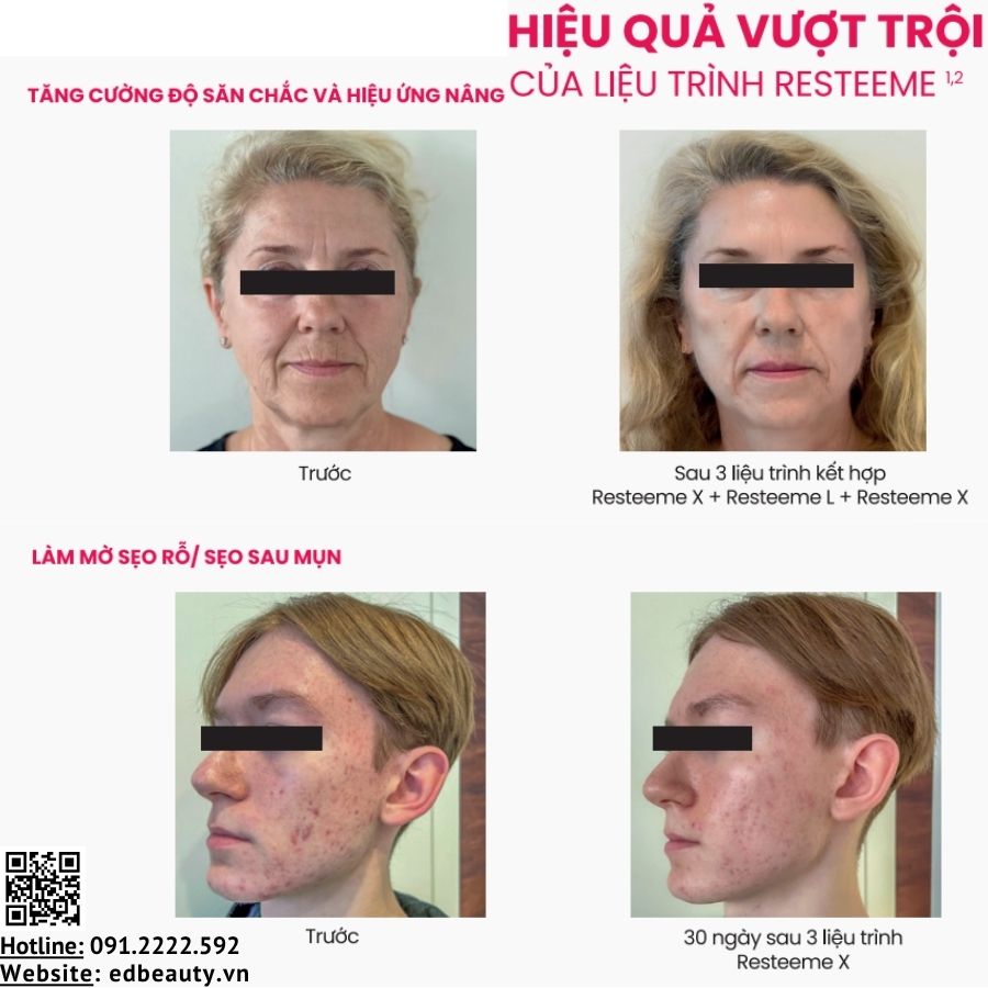 Resteeme - hệ giải pháp tái tạo sinh học cho nhiều nhu cầu của làn da